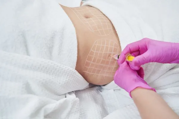 image of fat dissolving injections on love handles to help combat weight gain Westwood